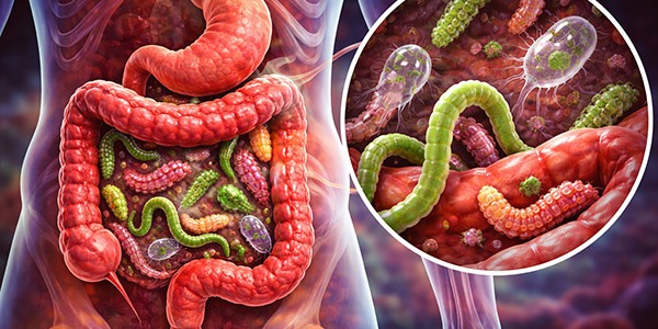 IBS (Zespół Jelita Drażliwego) - 90% To Pasożyty!